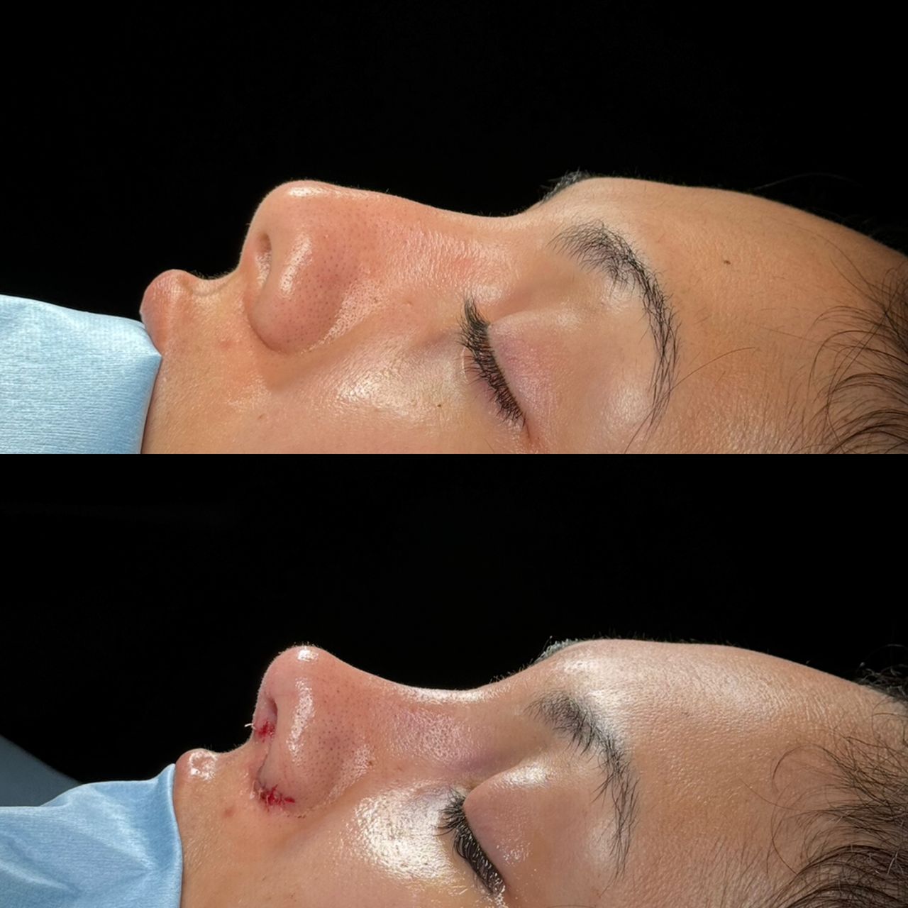 Angel Castro Urquizo-117