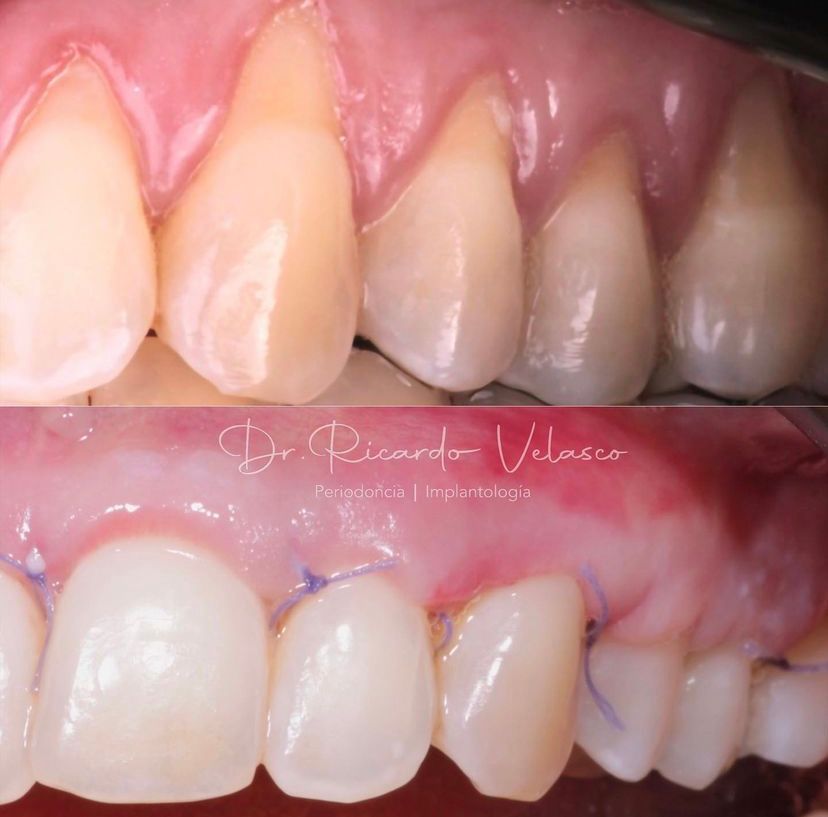 Ricardo Velasco Avelar-10