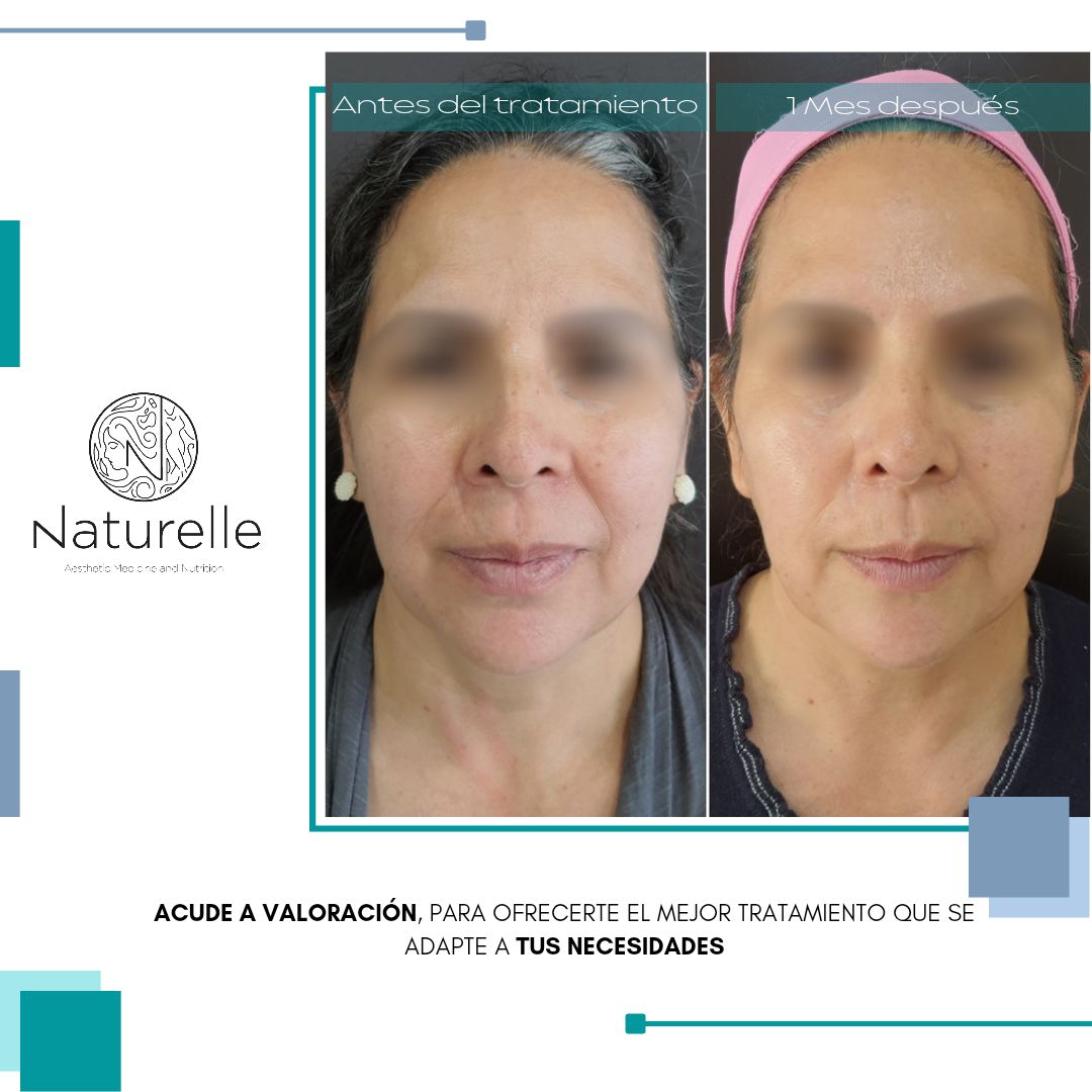 Daniel Marín Jasso-18