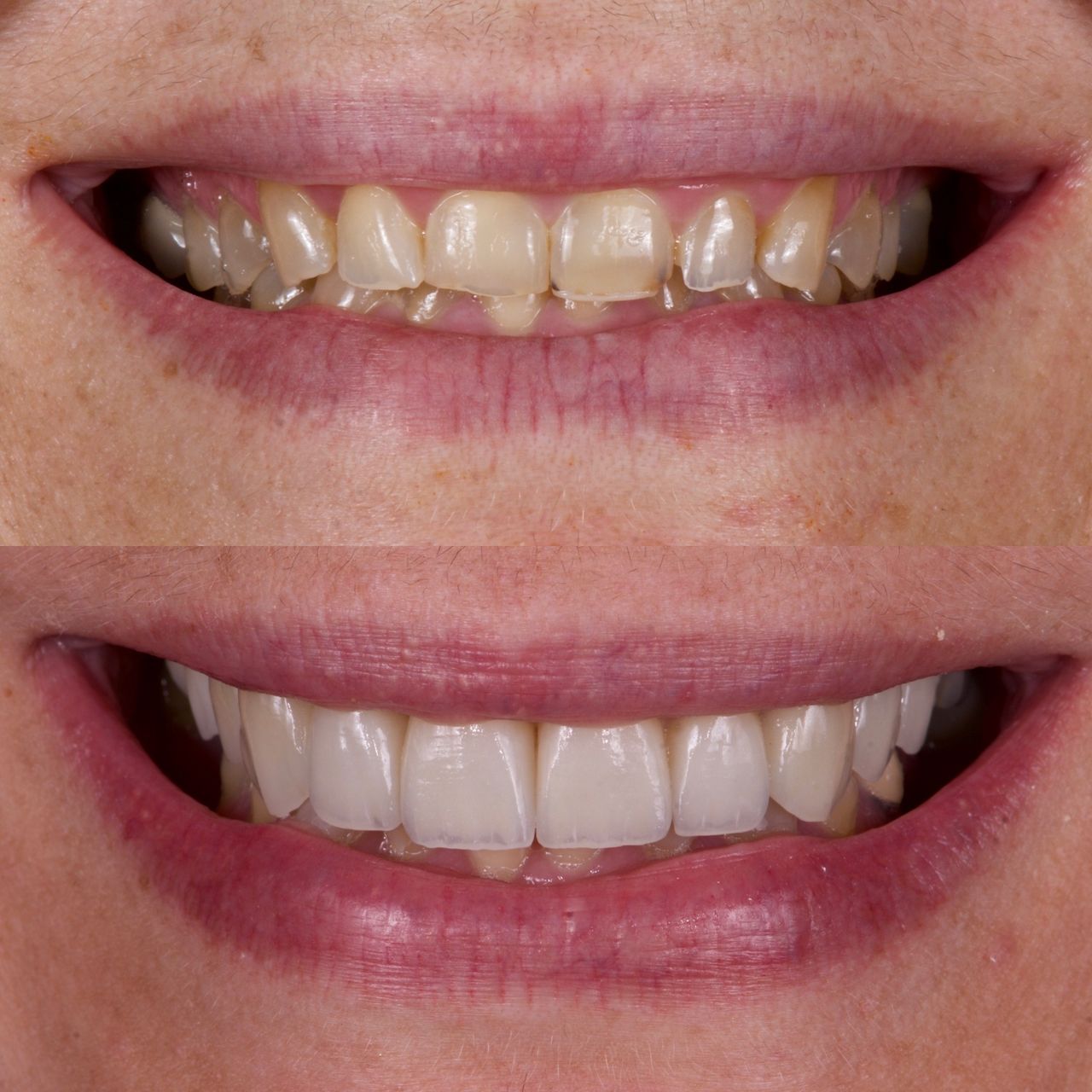 Mauricio Villegas Akena-20