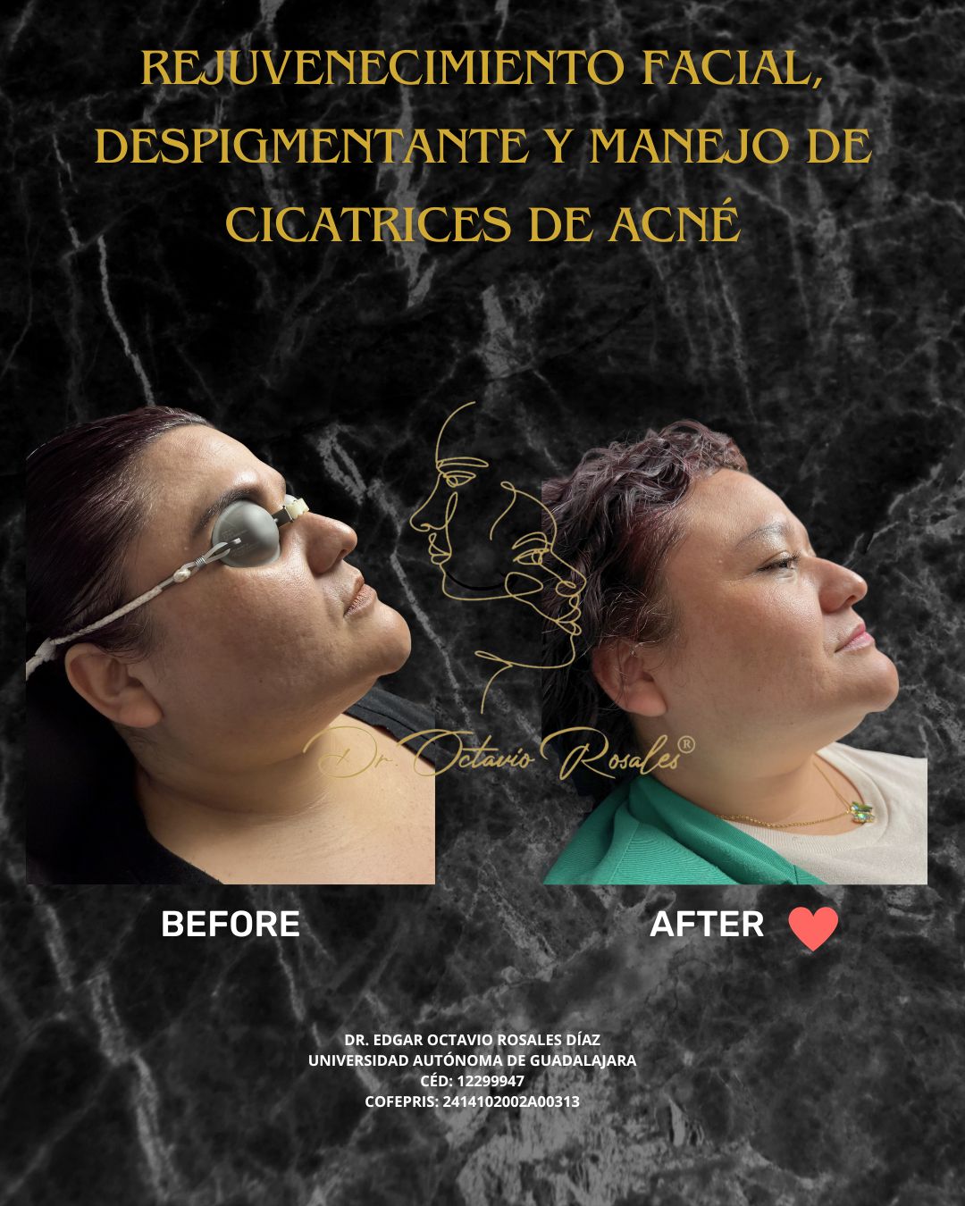 Edgar Octavio Rosales Diaz-23