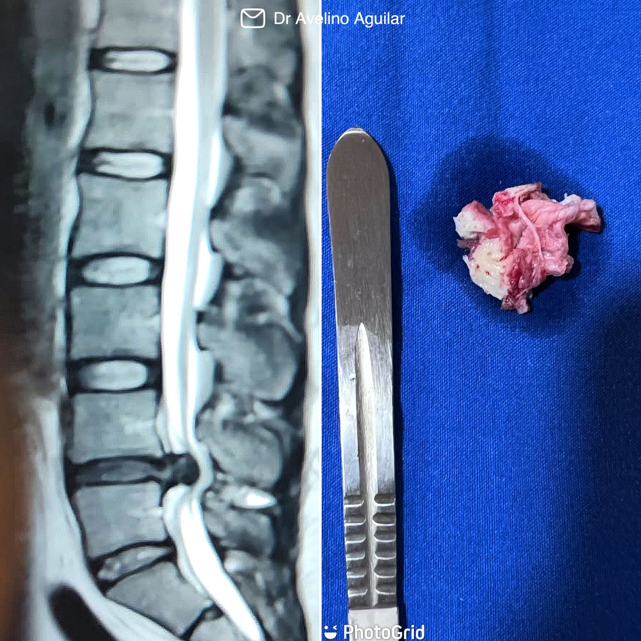 Avelino Aguilar Merlo-1