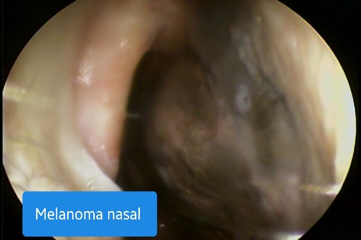 Damaris Yamel Neri Torres-3