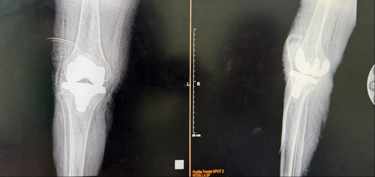 Carlos Tapia Hernández-3