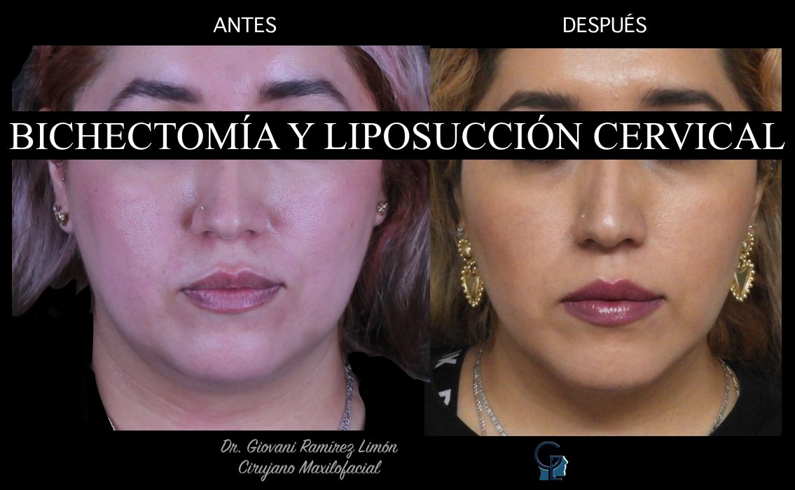 Giovani Ramírez Limón-17