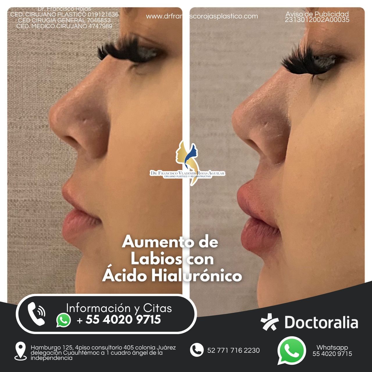 Francisco Rojas Aguilar-32