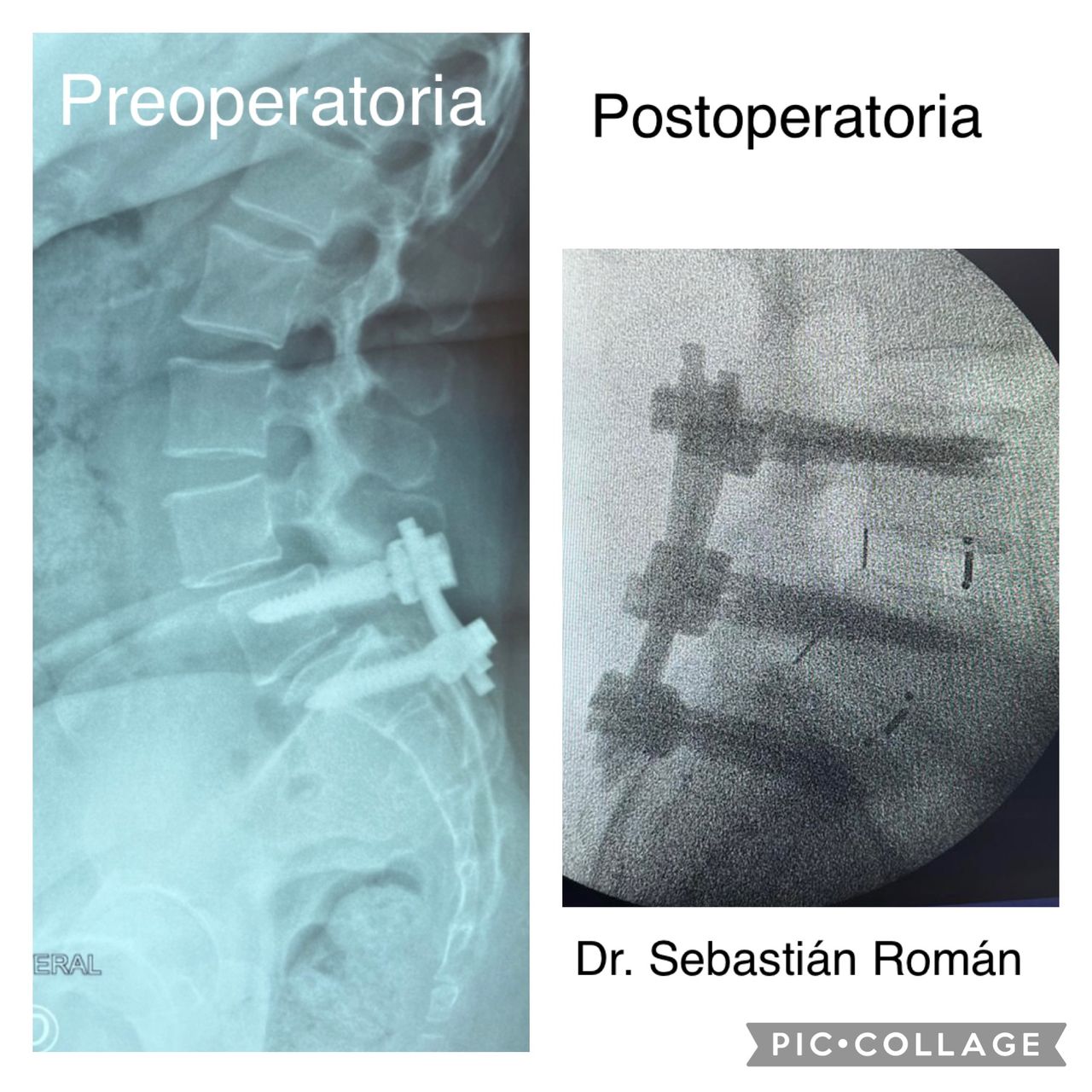 Sebastián Rodrigo Román González-32