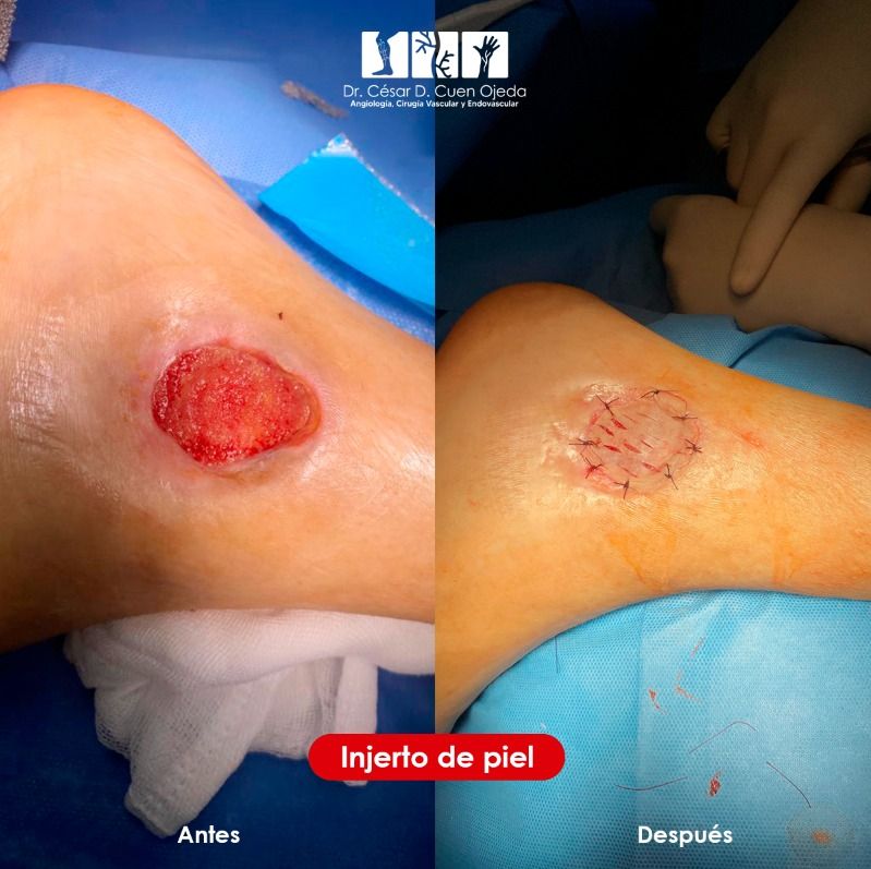 César Daniel Cuen Ojeda-20