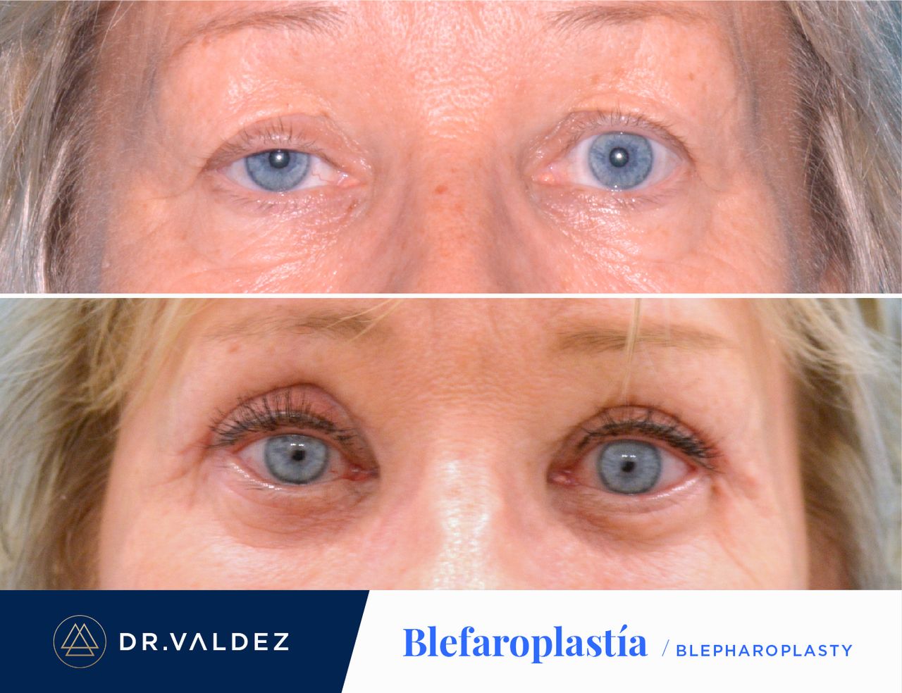 Pedro Arturo Valdez Gomez-32