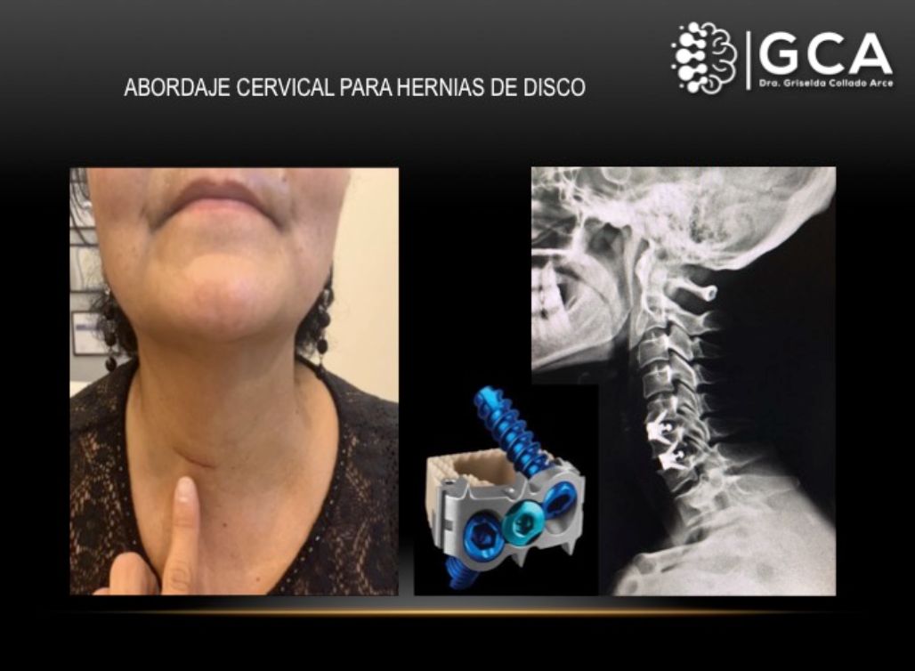 Griselda Collado Arce-16