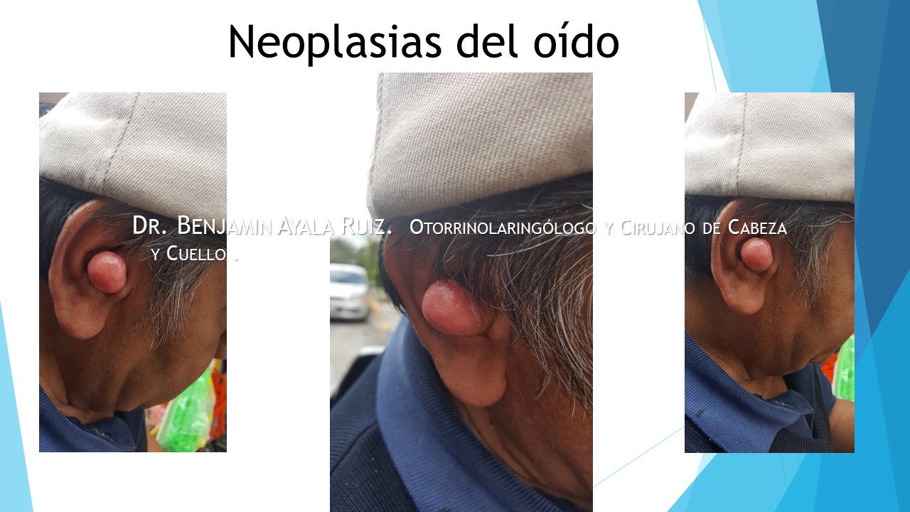 Benjamin Antonio Ayala Ruiz-18