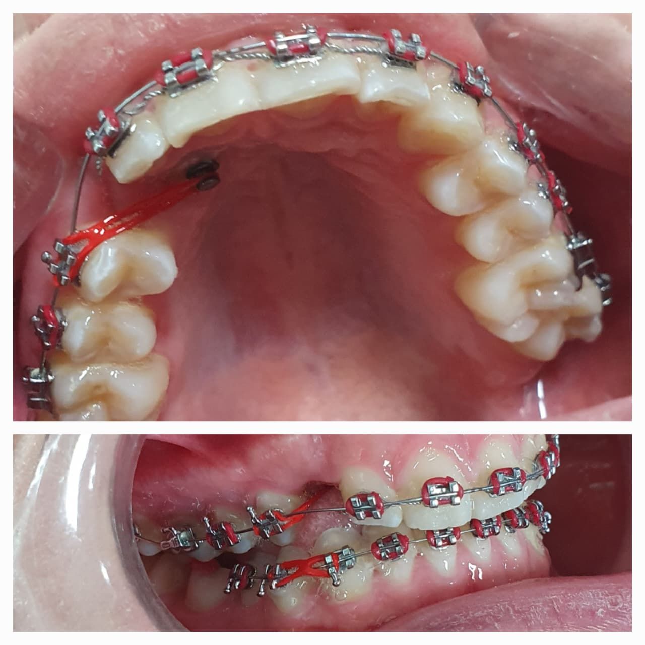 Teresa Virginia De Los Santos Falcón-1