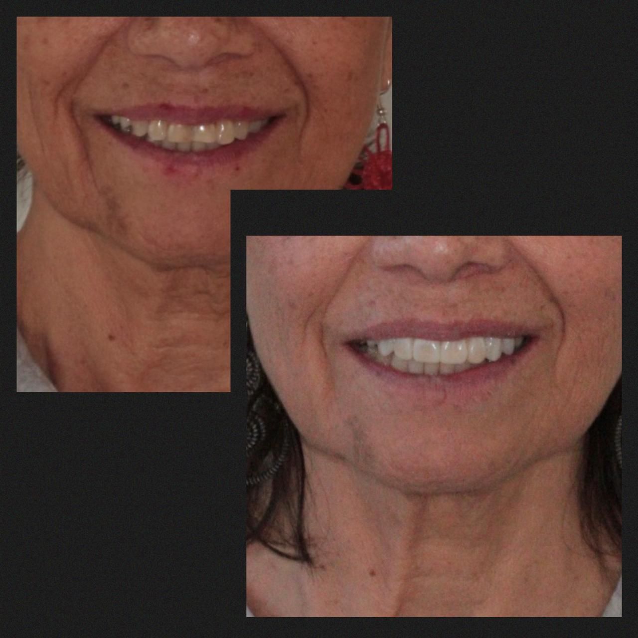 Ana Karen Tenorio Vargas-2