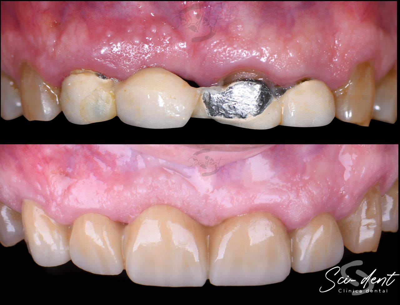 Carlos Antonio Villalvazo Velasco-10