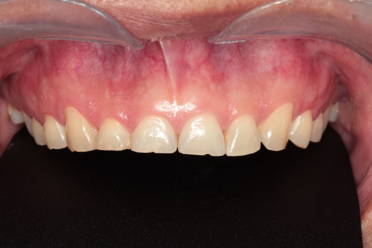 Mariel Itzayani Torres López-20