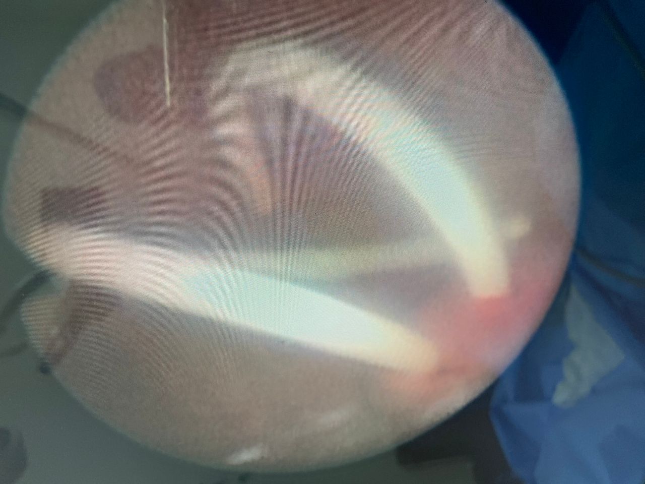 Roberto Juvenal Pérez Avila-11