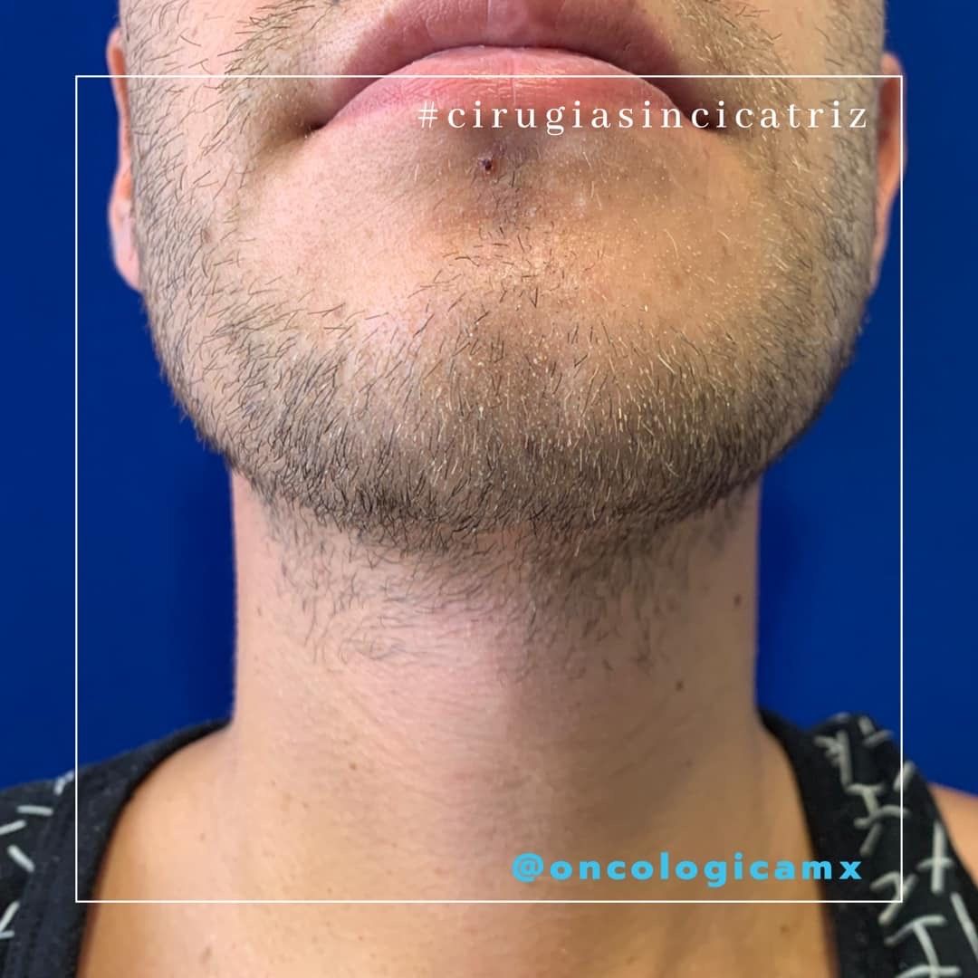 Manuel Acuña Tovar-3