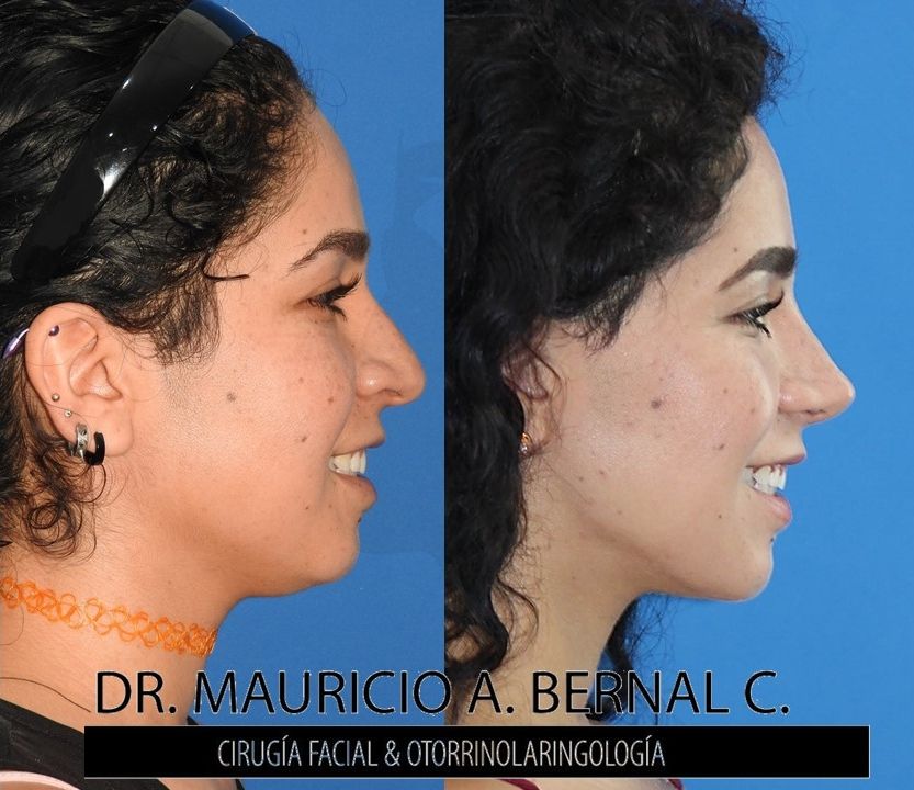 Mauricio Alejandro Bernal Carreon-6