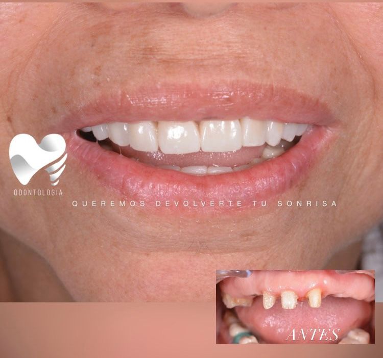 Katherine Betzabet Regil Rojas-8