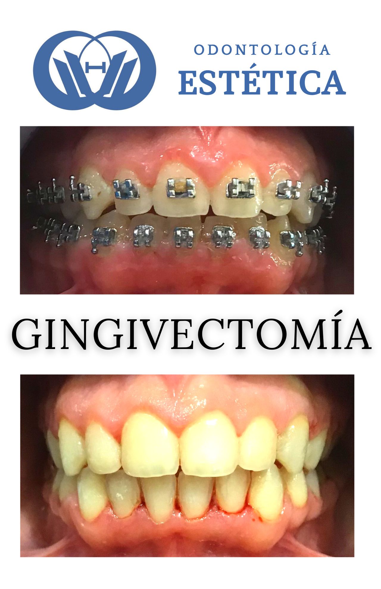 Verónica Olmedo Sánchez-6