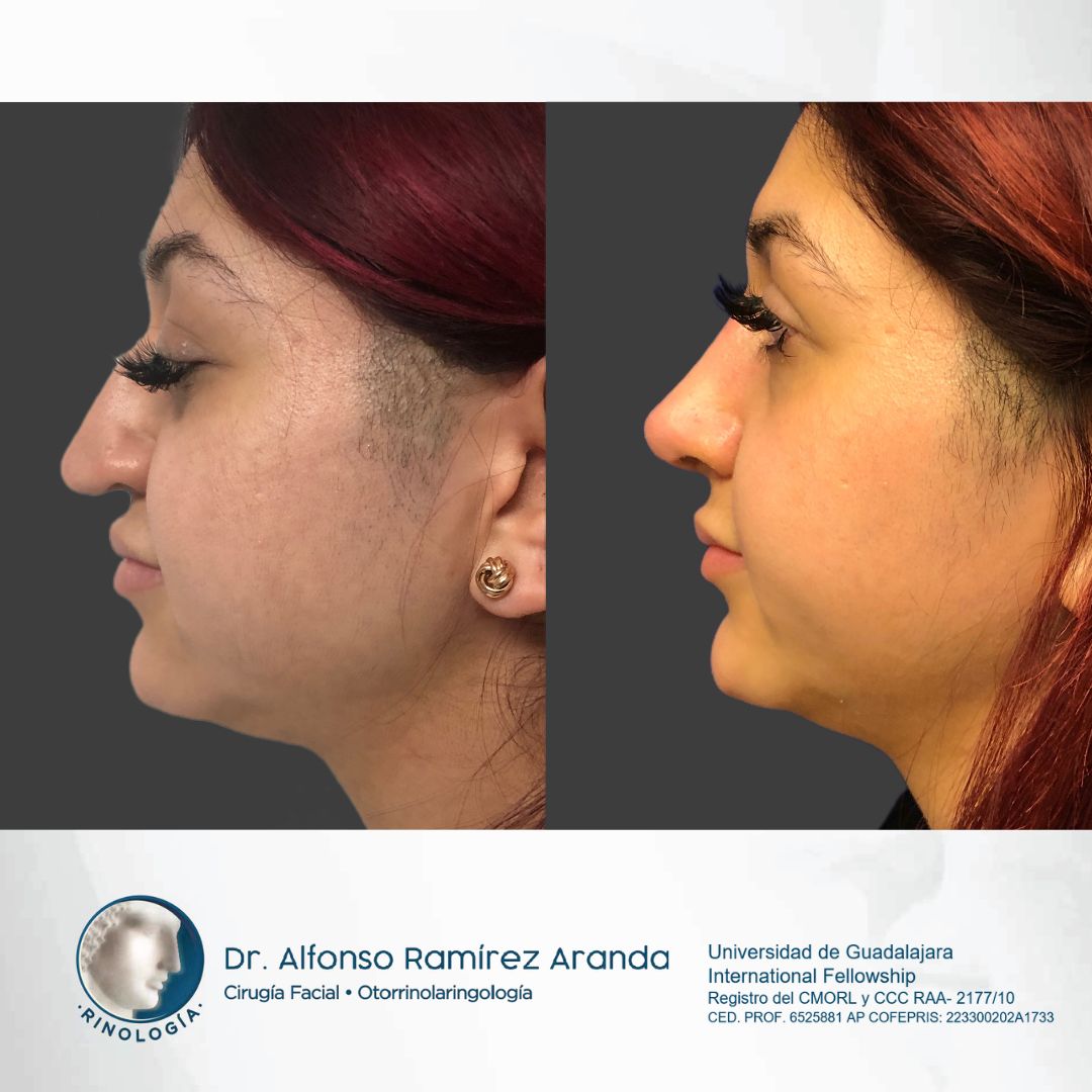 Alfonso Ramírez Aranda-30