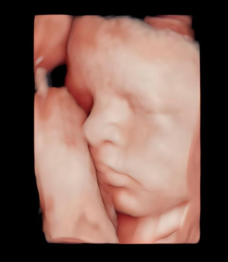 Katia Yareli Viera Ibarra-12