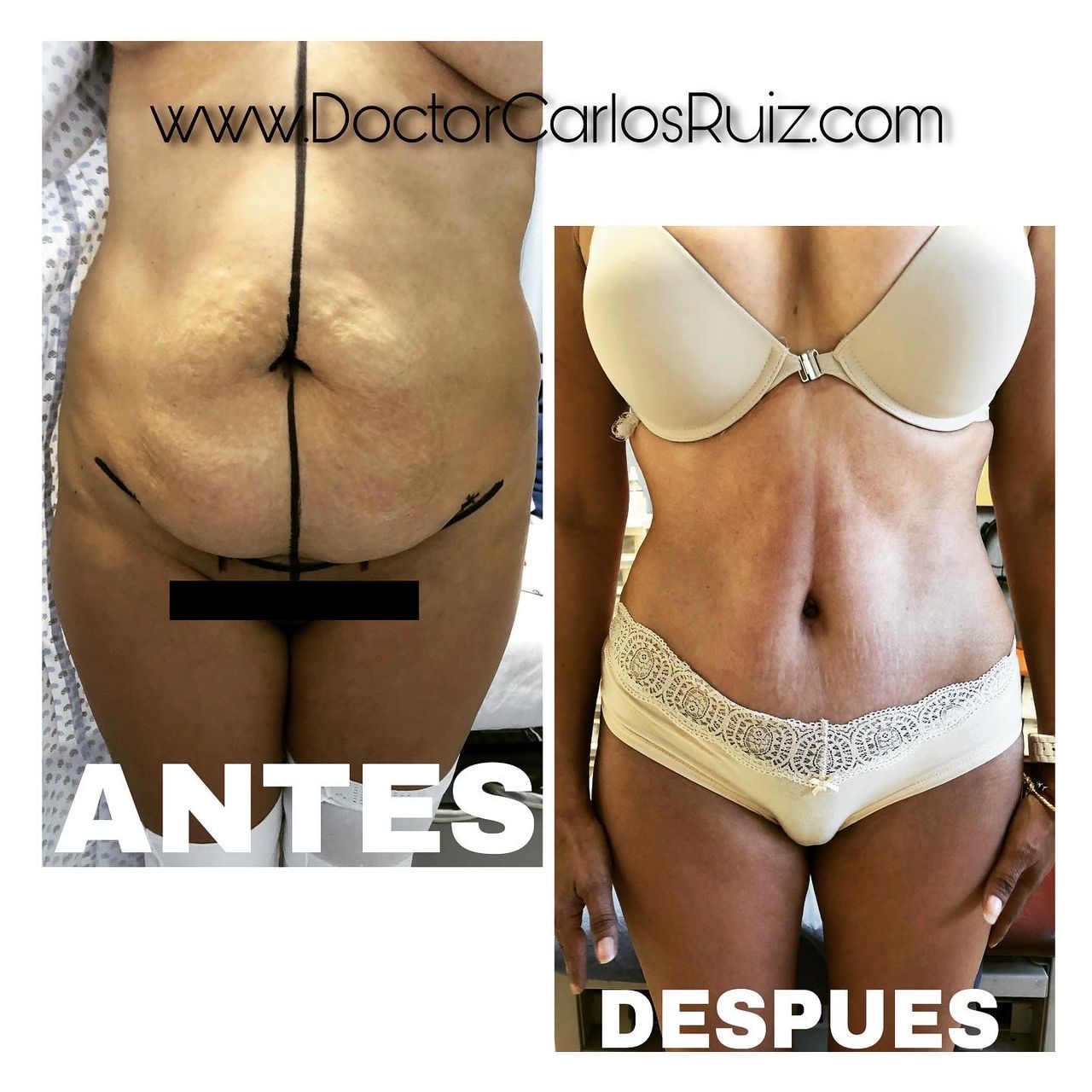 Carlos Alberto Ruiz Zepeda-8