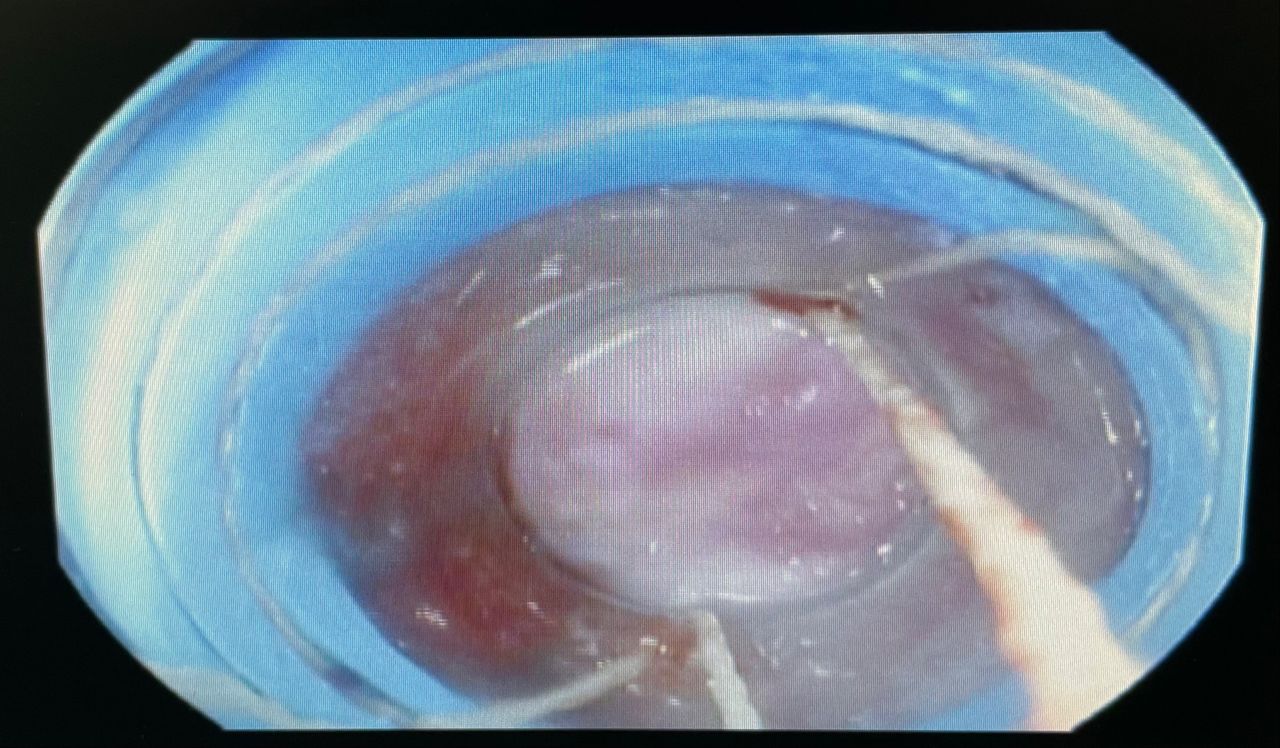 Byron Campoverde Arevalo-4