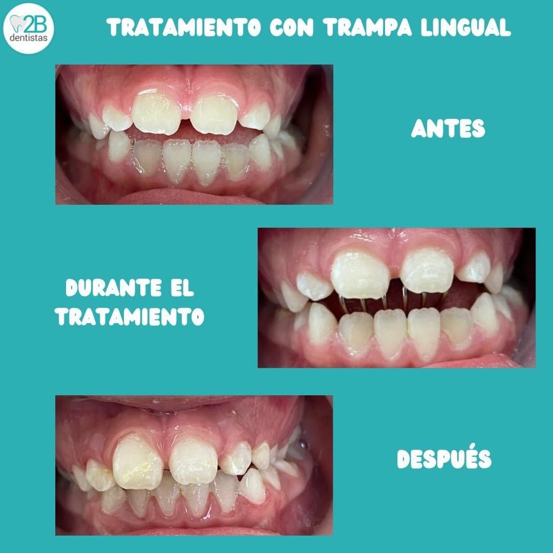 Brenda Carolina Hernández Martell-2