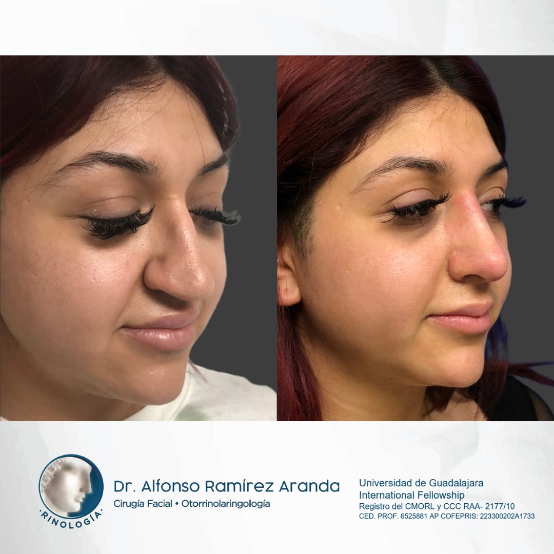 Alfonso Ramírez Aranda-29