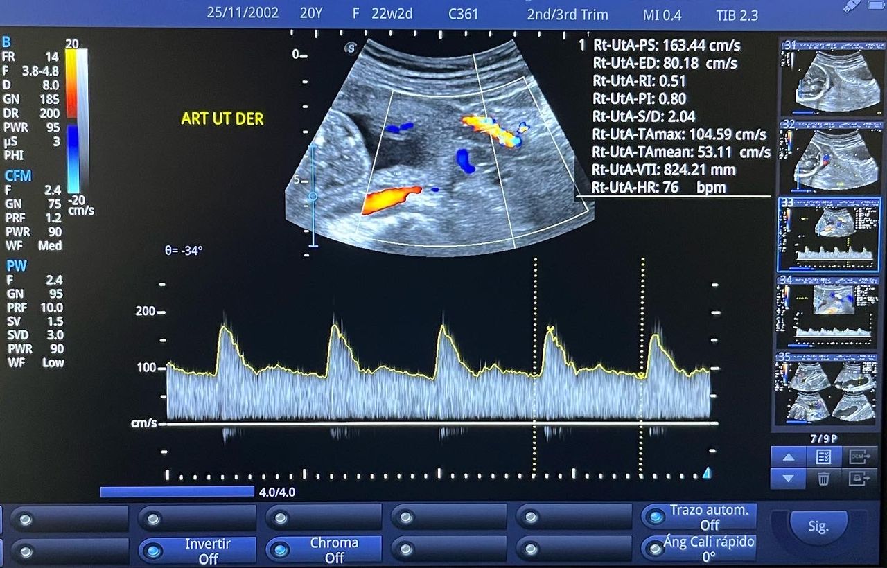 César Guerra Martínez-45