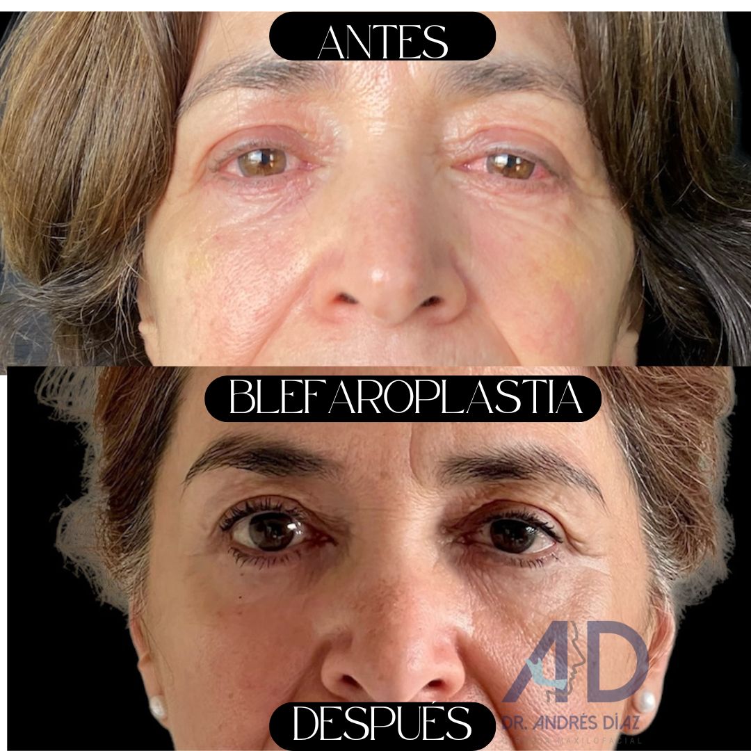 Andres Diaz Moreno-8