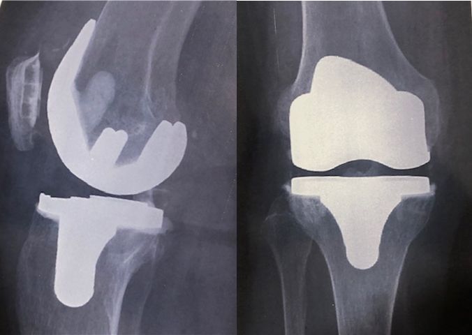 Alejandro Parés Rubí-2