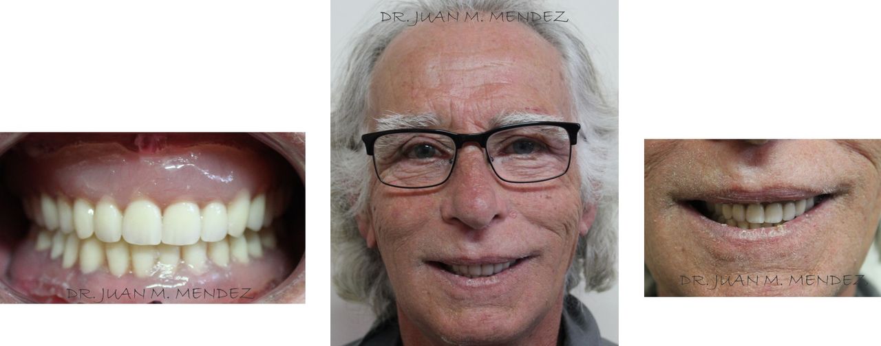 Juan Manuel Méndez Ferrusco-9