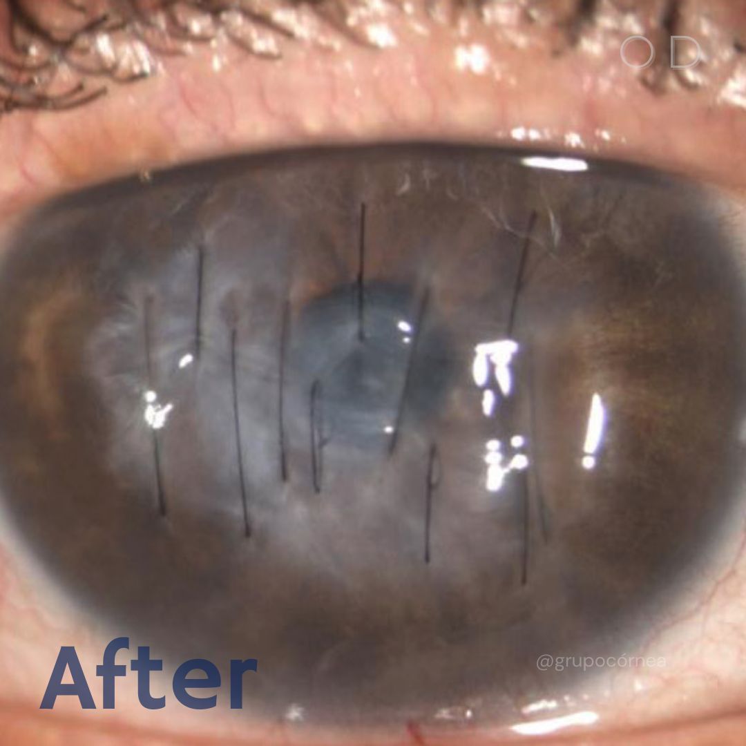 Kristian Alfonso Vazquez Romo-4