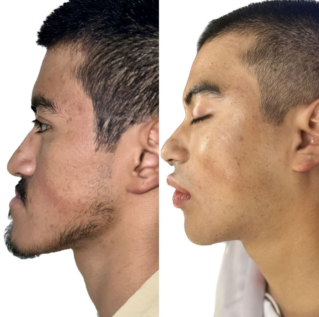 Kevin Matheus Flores Moraz-4