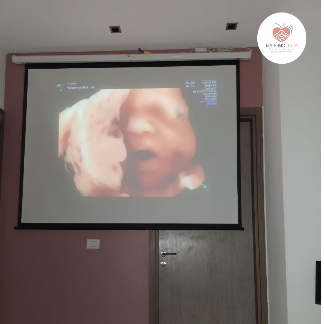 Krista Yazareth Enriquez Lopez-10