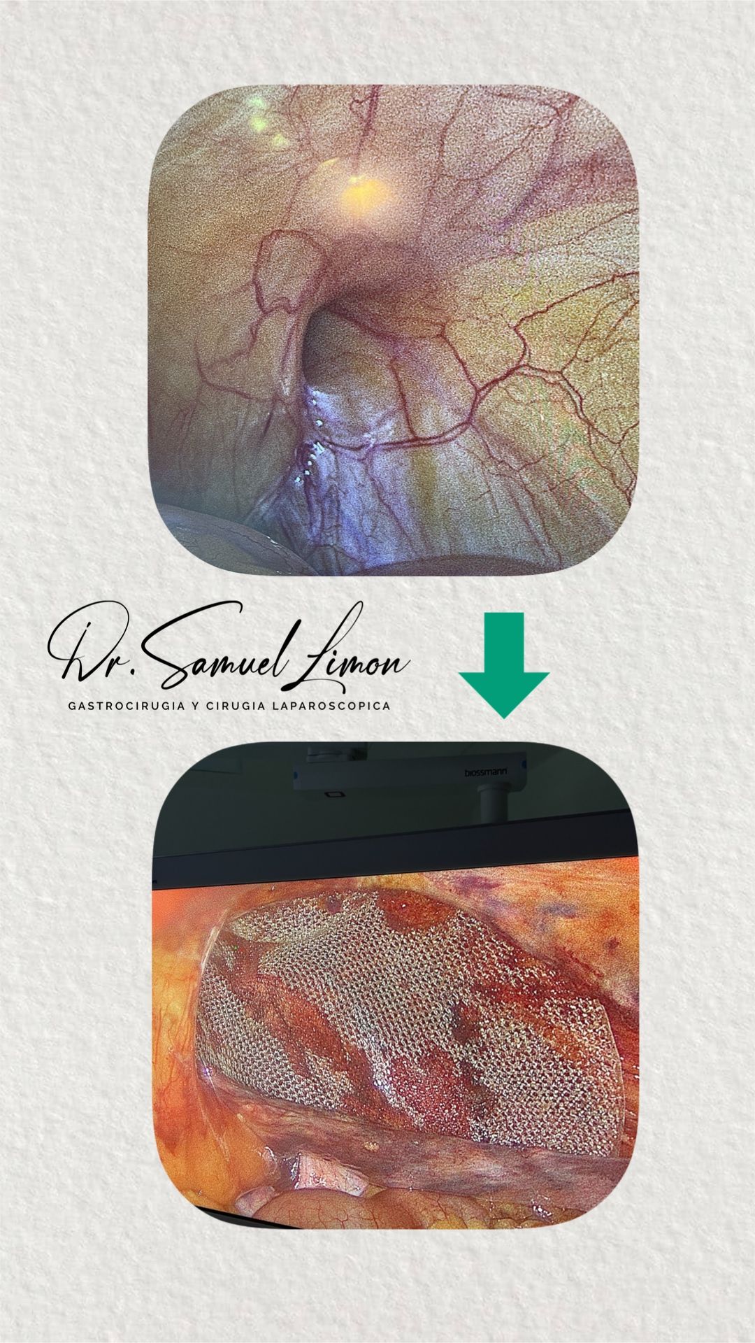 Samuel Limón Suarez-7