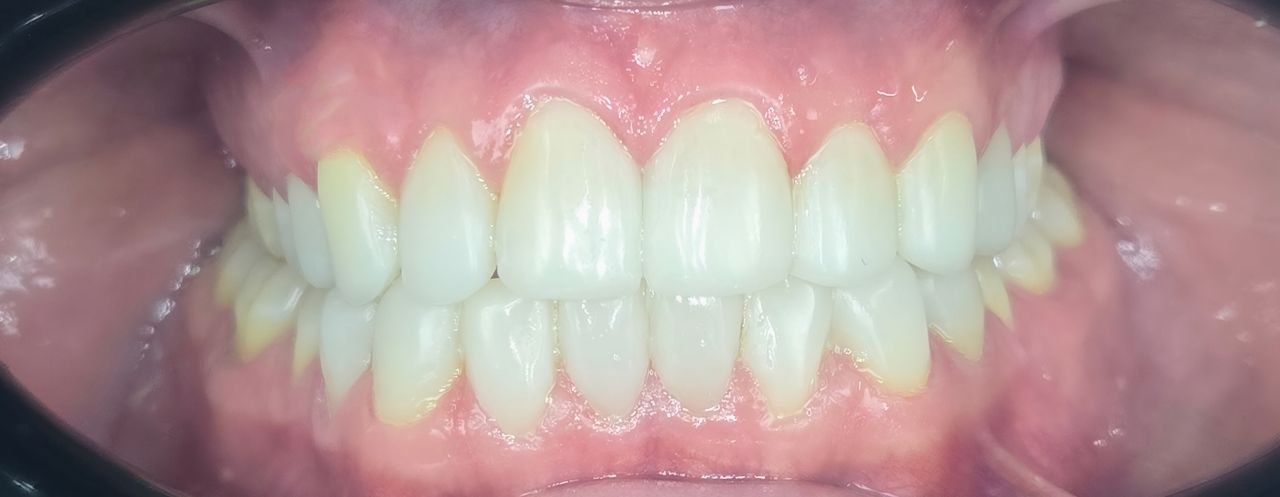 Edgardo Caballero Dávila-17