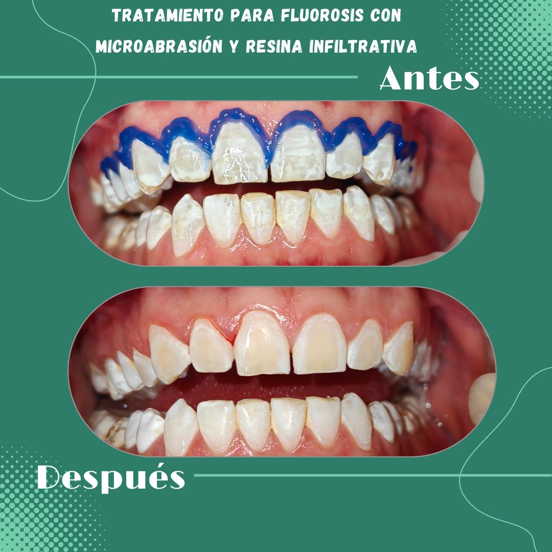 Sibely Yaraset Aranda Rodríguez-0