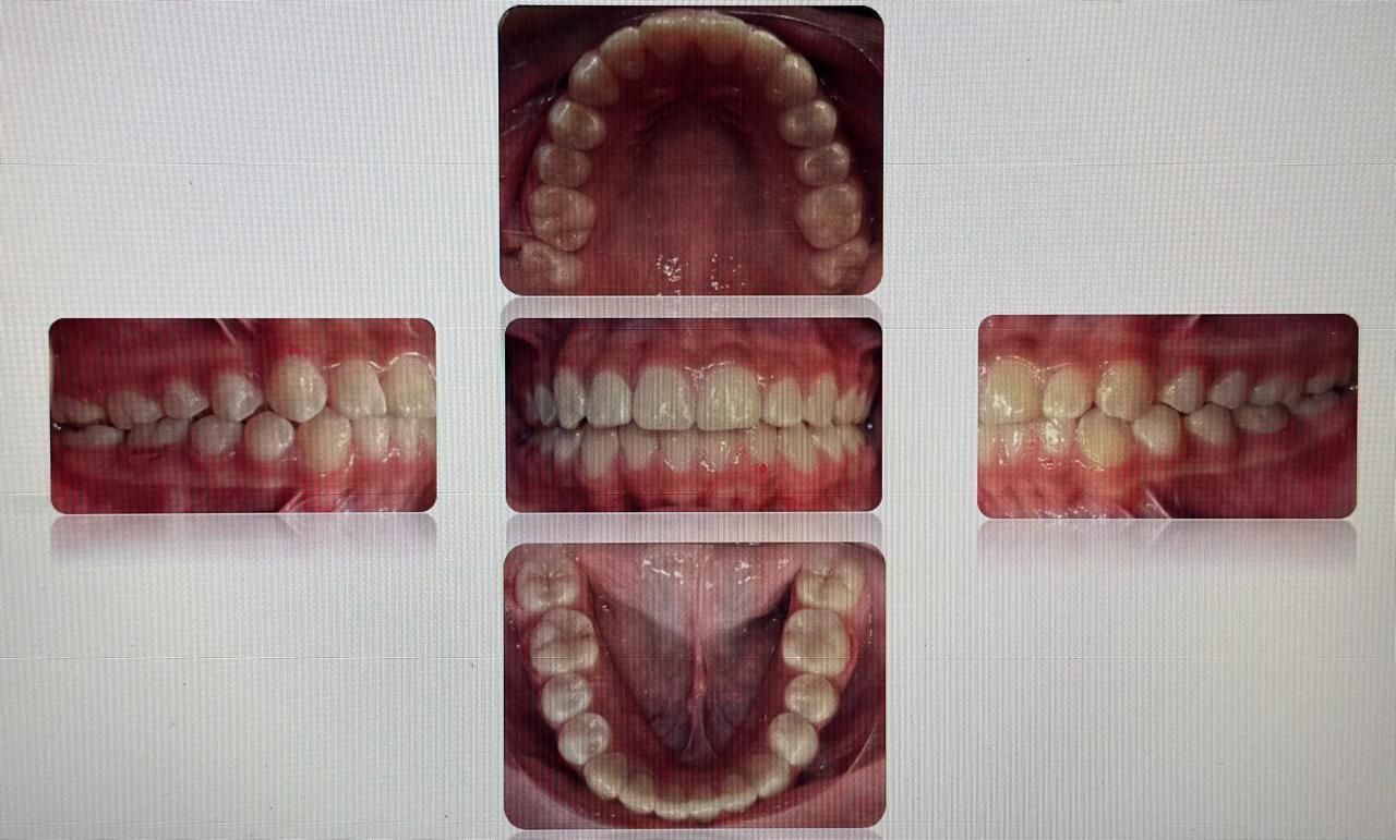 Antonio Gomez Arenas-17