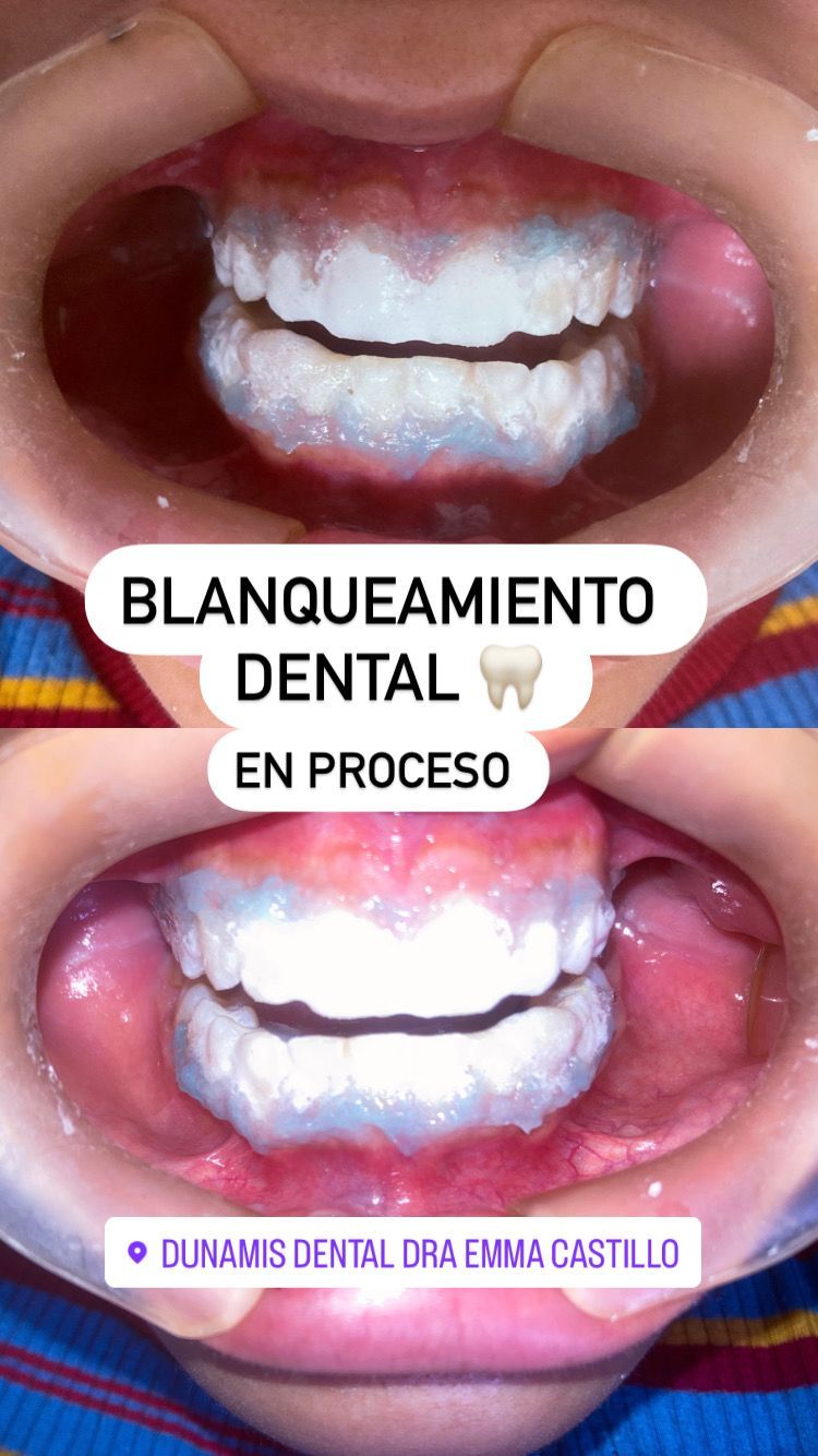 Emma Selenia Hernández Castillo-3