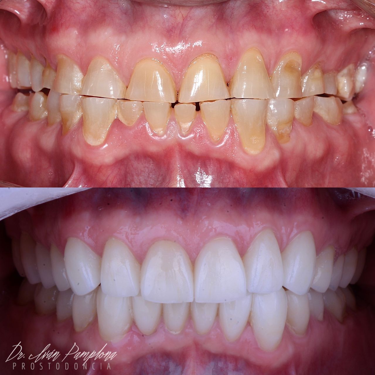 Iván Gerardo Pamplona Alfaro-1