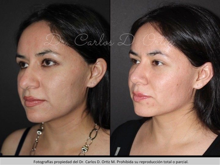 Carlos David Ortiz Moreno-25