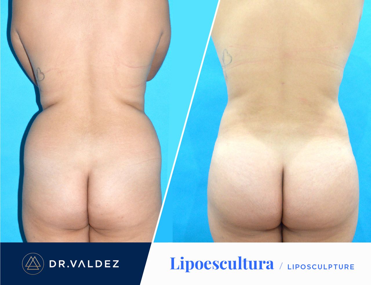 Pedro Arturo Valdez Gomez-19