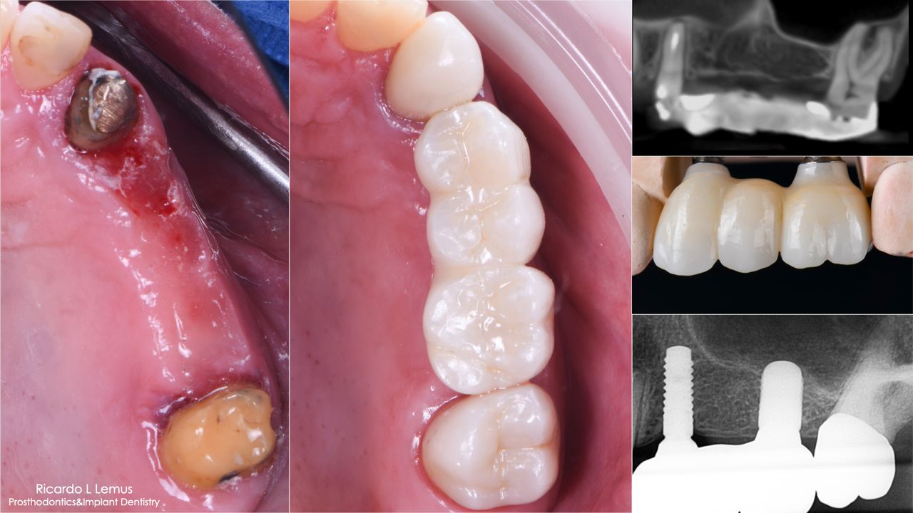 Ricardo López Lemus-92