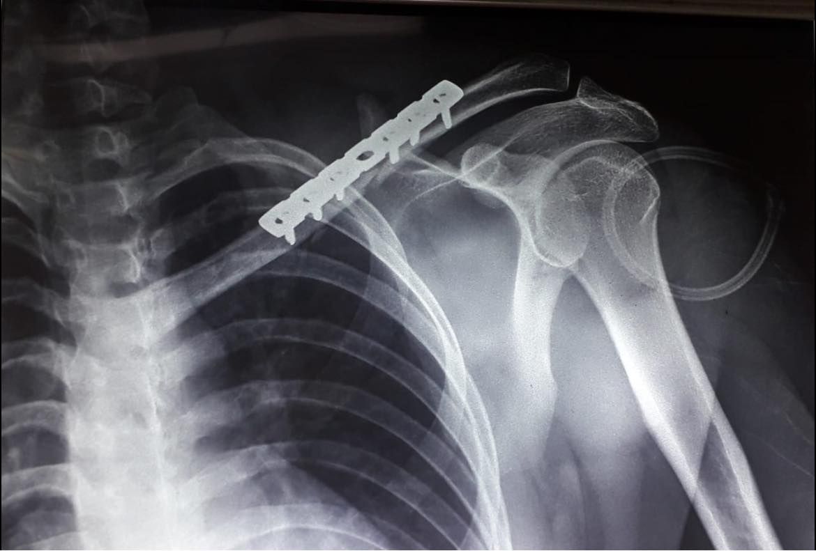 Felix Alfaro Arias-11