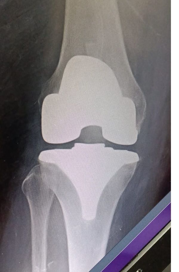 Jorge Yair Álvarez Ojeda-4