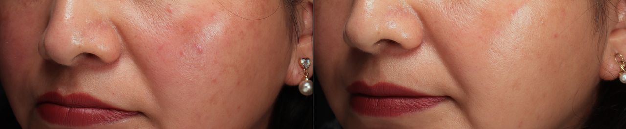 Lauro Francisco Varela Coronado-8