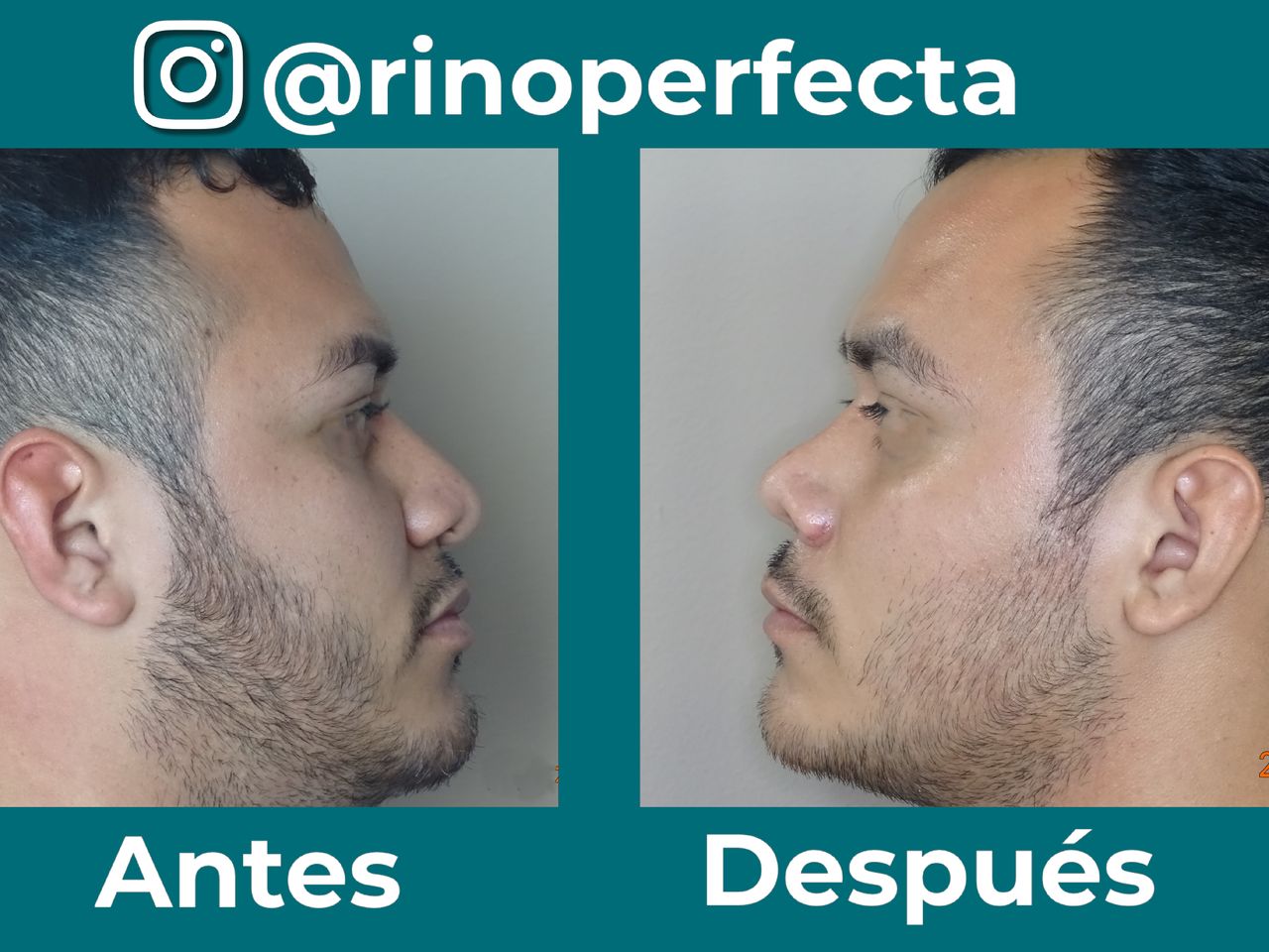 Juan Manuel Esparza Alejandre-17